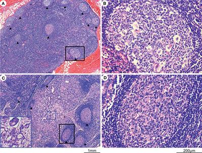 Prognostic and predictive values of the grading system of lymph node status in patients with advanced-stage gastric cancer